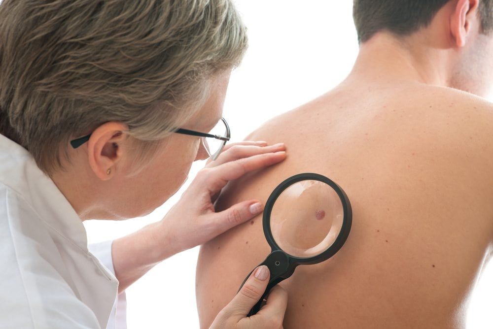 Doctor Examining a spot on a patients back with a magnifying glass