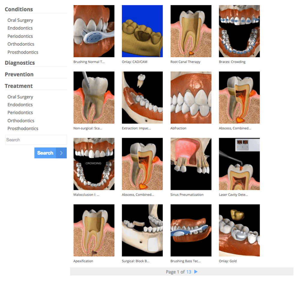 Video interface created by 3d4 displaying dental categories and 3d dental procedures