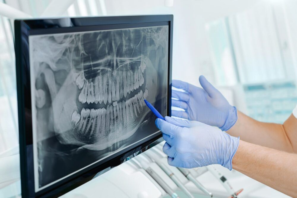 Dentist showing xray on monitor